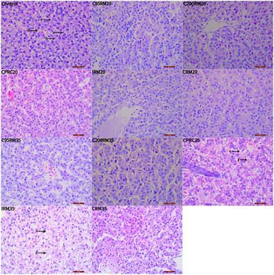 High replacement of soybean meal by different types of rapeseed meal is detrimental to rainbow trout (Oncorhynchus mykiss) growth, antioxidant capacity, non-specific immunity and Aeromonas hydrophila tolerance